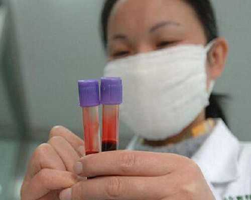 卵巢早衰吃什么维生素