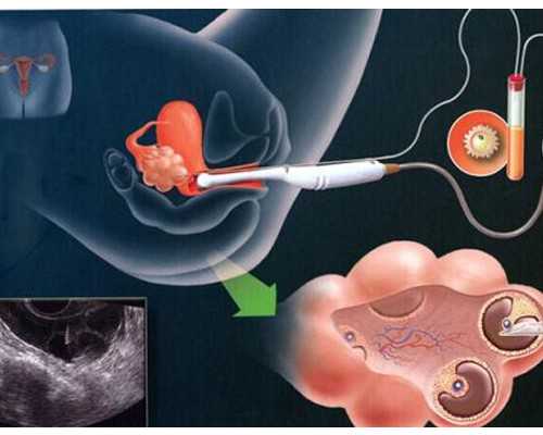 合肥有没有做供卵医院,2024
合肥试管包生男孩医院怎么选？